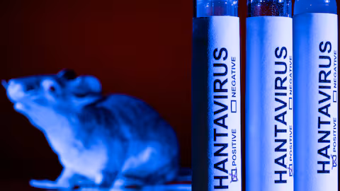 Vigilancia epidemiológica en Cuba por hantavirus