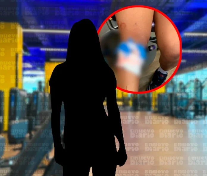 Mujer herida en pelea de gimnasio en Bávaro