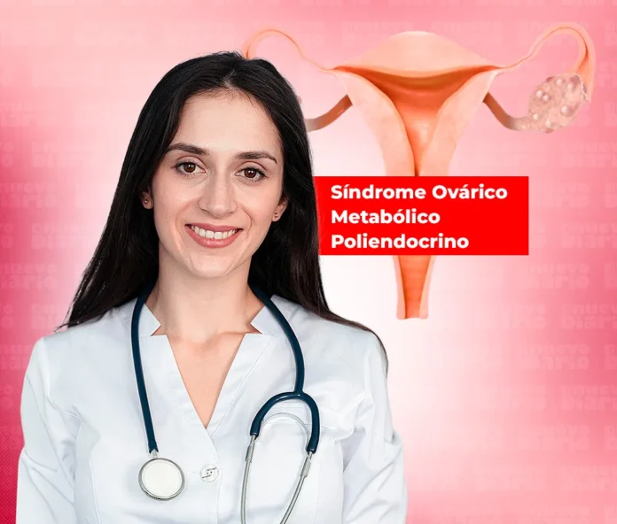 Cambio de nombre del síndrome ovárico.