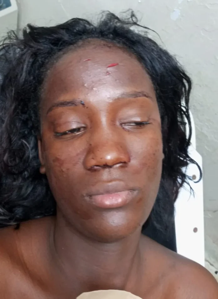 Mujer herida en riña con botella.