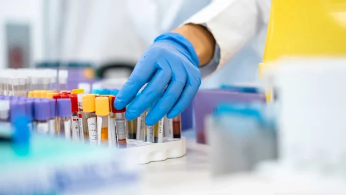 Test sanguíneo para detectar cáncer de páncreas.